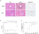 Galectin 3 Antibody in Immunohistochemistry (IHC)