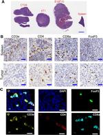 FOXP3 Antibody in Immunohistochemistry (IHC)