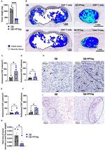 CD4 Antibody in Immunohistochemistry (IHC)