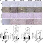 Transferrin Receptor Antibody in Immunohistochemistry (IHC)
