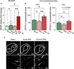 GFAP Antibody in Immunohistochemistry (IHC)
