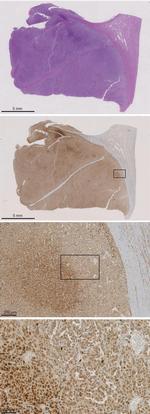 FBXW7 Antibody in Immunohistochemistry (IHC)