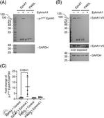 Phospho-EphA1 (Tyr781) Antibody in Western Blot (WB)