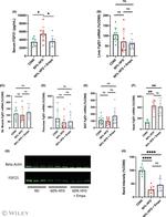 FGF21 Antibody in Western Blot (WB)