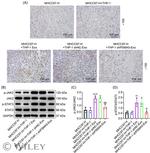 CD206 Antibody in Immunohistochemistry (IHC)