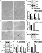 PLZF Antibody in Western Blot (WB)