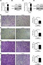 SPINK5 Antibody in Western Blot (WB)