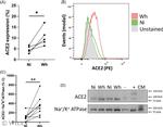 ACE2 Antibody in Western Blot (WB)