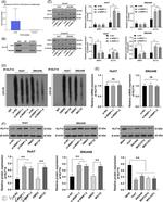 KLF14 Antibody in Western Blot, ChIP Assay (WB, ChIP)