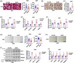 PRDM16 Antibody in Western Blot (WB)