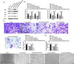 VDR Antibody in Western Blot (WB)