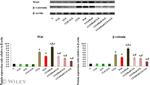 beta Catenin Antibody in Western Blot (WB)