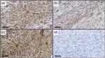 Desmin Antibody in Immunohistochemistry (IHC)