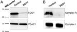 SCO1 Antibody in Western Blot (WB)