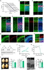 KCTD10 Antibody in Western Blot (WB)