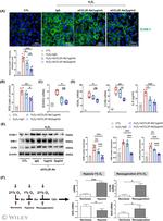 CCL20 Antibody in Neutralization (Neu)