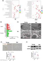 FCGR2B Antibody in Immunohistochemistry (IHC)