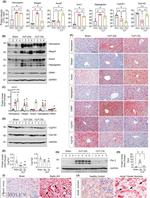 Hemopexin Antibody in Western Blot, Immunohistochemistry (WB, IHC)