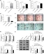 TXNIP Antibody in Western Blot (WB)