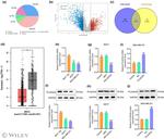 PLA2G2A Antibody in Western Blot (WB)