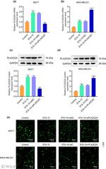 PLA2G2A Antibody in Western Blot (WB)