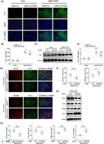 CD16 Antibody in Western Blot (WB)