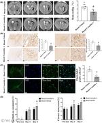 Myeloperoxidase Antibody in Immunohistochemistry (IHC)