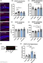 GFAP Antibody in Western Blot (WB)