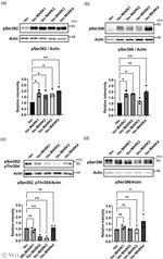Tau Antibody in Western Blot (WB)