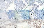 TRPS1 Antibody in Immunohistochemistry (IHC)