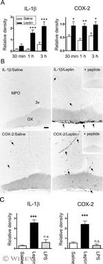 IL-1 beta Antibody in Immunohistochemistry (IHC)