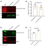 Phospho-CPI-17 (Thr38) Antibody in Western Blot (WB)