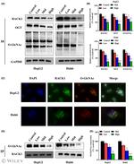 O-linked N-acetylglucosamine (O-GlcNAc) Antibody in Western Blot (WB)