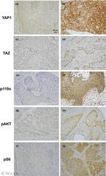 YAP1 Antibody in Immunohistochemistry (IHC)