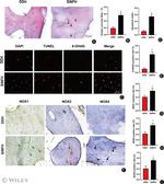 NOX1 Antibody in Immunohistochemistry (IHC)