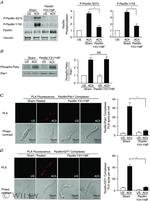 Phospho-Paxillin (Tyr118) Antibody in Western Blot (WB)