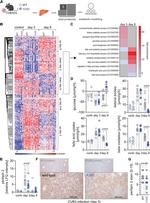 ADFP Antibody in Immunohistochemistry (IHC)
