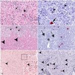 CD20 Antibody in Immunohistochemistry (IHC)