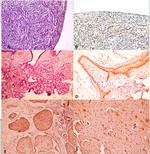 p16INK4a Antibody in Immunohistochemistry (IHC)