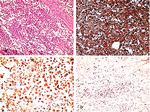 p16INK4a Antibody in Immunohistochemistry (IHC)
