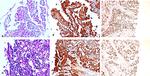 p16INK4a Antibody in Immunohistochemistry (IHC)