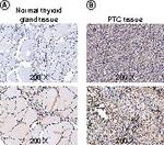 PLK4 Antibody in Immunohistochemistry (IHC)