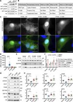 EEF1D Antibody in Western Blot (WB)