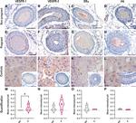 VEGF Receptor 2 Antibody in Immunohistochemistry (IHC)