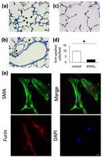 Furin Antibody in Immunohistochemistry (IHC)