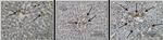 Insulin/Proinsulin Antibody in Immunohistochemistry (IHC)