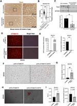 TBX3 Antibody in Immunohistochemistry (IHC)