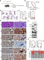 Cytokeratin 5 Antibody in Immunohistochemistry (IHC)
