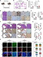 Cytokeratin 5 Antibody in Immunohistochemistry (IHC)