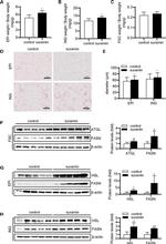 ATGL Antibody in Western Blot (WB)
